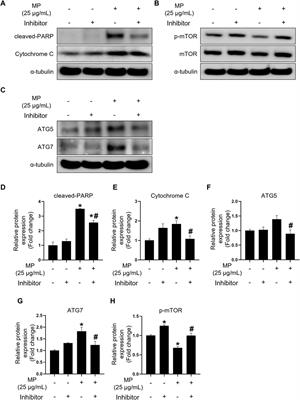 Elucidating the mechanisms and mitigation strategies for six-phthalate-induced toxicity in male germ cells